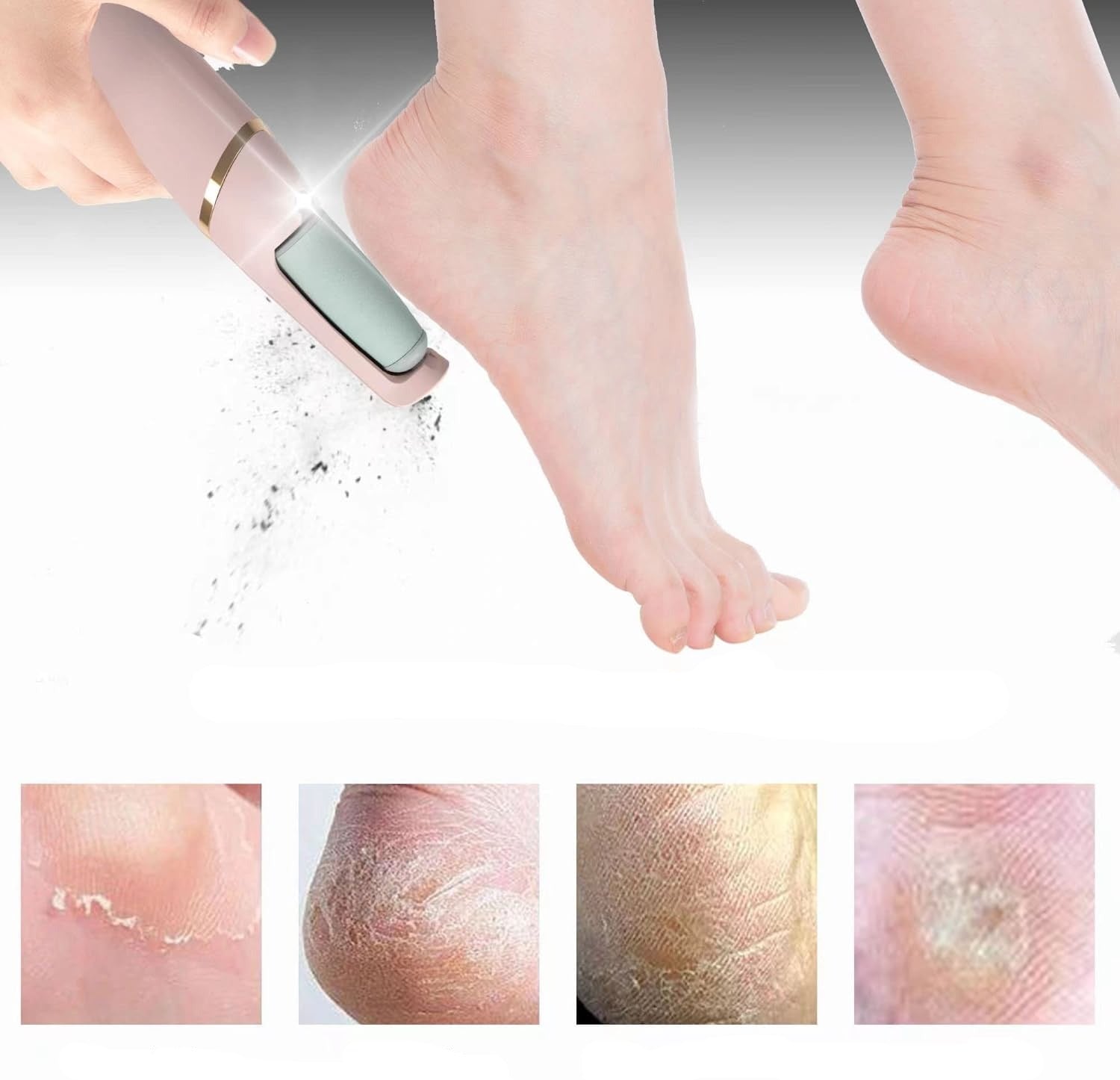 Electric Foot Callus Remover for Everyday Beauty Care