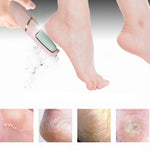 Electric Foot Callus Remover for Everyday Beauty Care